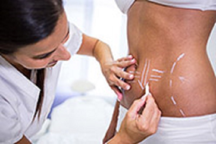 aesthetics treatment antalya aesthetics treatment antalya