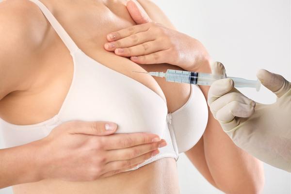 Non-surgical breast lift